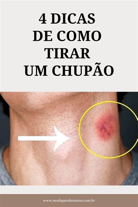 como tirsr chupao|Como Tirar um Chupão: Dicas Eficazes e Rápidas